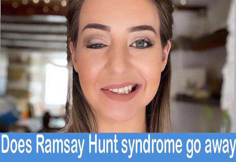 what causes ramsay hunt syndrome